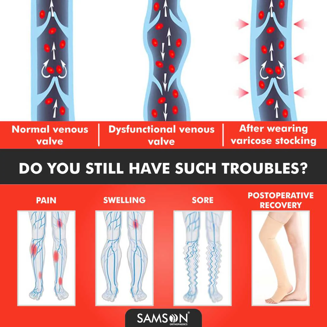 SAMSON Varicose Veins Compression Stockings (Below Knee) | Swelling, Edema & Pain Relief for Men & Women - Image 3